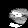 SPORK, NICO - 22.03.1976 - 02.08.2022 - CT obere Extremität - 17:51:17